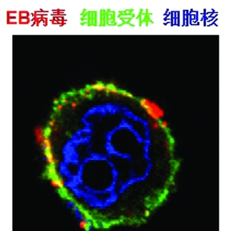 EB病毒是什么 非常像感冒的病毒