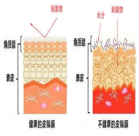 激素脸怎么治疗 这些治疗误区千万注意