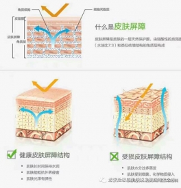 角质层过薄，你该怎么修护？