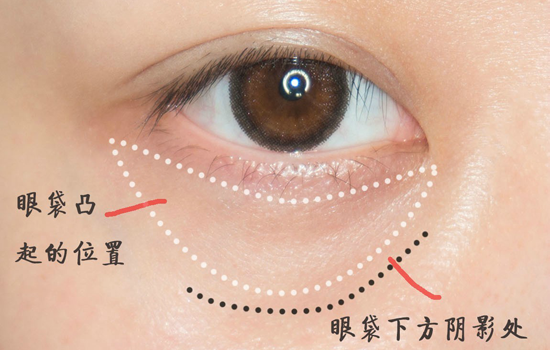 遮黑眼圈妆容教程 三种方法遮住熊猫眼