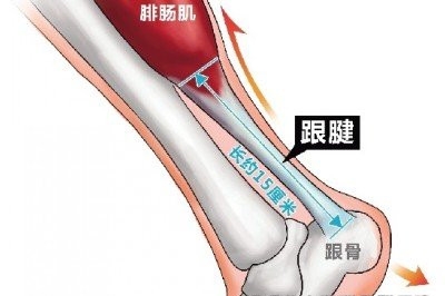 瘦小腿肚的最快方法 在夏天前变身长腿少女