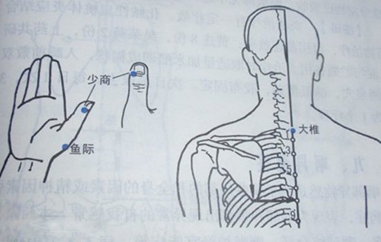 慢性咽炎怎么调养 助你告别慢性咽炎