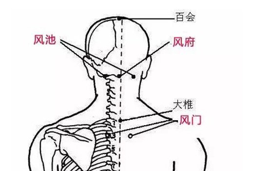 中暑刮痧刮哪些部位 夏季中暑的刮痧疗法