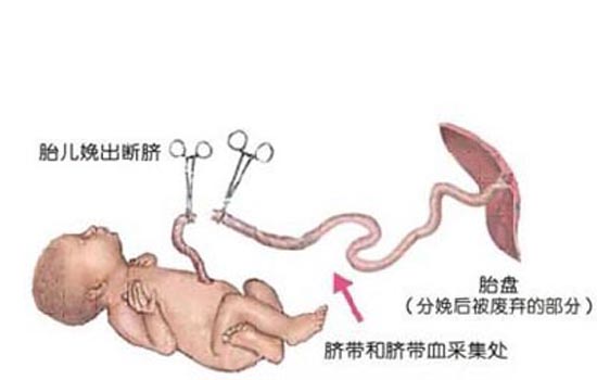 脐带血有必要保存吗 为您详解脐带血的热门问题