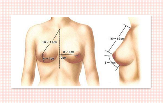 假体隆胸能母乳吗 看看你隆胸术后能不能哺乳