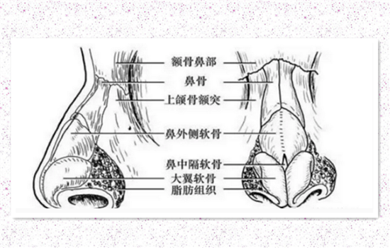 鼻中隔隆鼻好还是耳软骨好 鼻中隔胜在能避免两处创伤