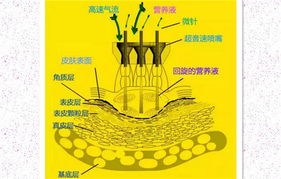 什么是无针水光 科普文让你不再一脸黑人问号