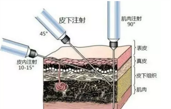 嗨体可以打泪沟吗 嗨体填充救泪沟你要知道这些