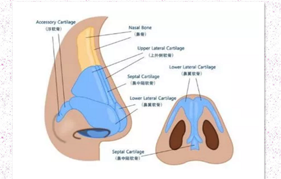 L型假体一定会顶穿吗 你不可不知的L型假体缺点