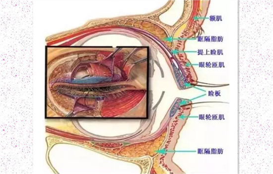 上睑下垂的原因和治疗 上睑下垂最全解析不看后悔