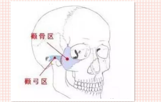 打瘦脸针后为什么显老 这3个原因导致你变美不成反显老