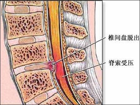 脖子为什么一转就响 脖子一转就嘎巴响的原因