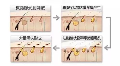 去黑头的产品 打败草莓鼻很简单