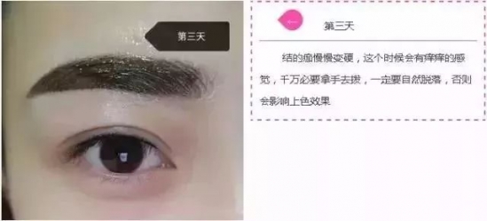 纹眉七天的变化 小仙女快看过来吧