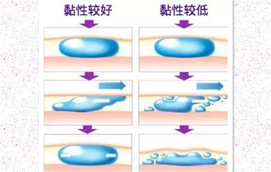 伊婉c型和v型的区别 玻尿酸微整前别再傻傻地被人忽悠