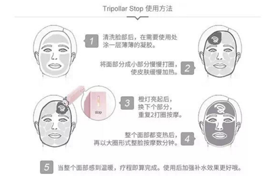 Tripollar stop正确使用频率 想要好效果的你一定要知道