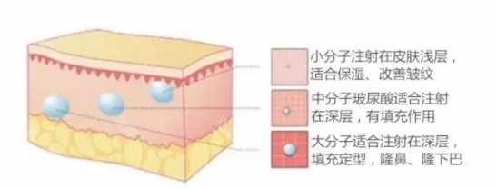 水光针和玻尿酸的区别 你应该打水光针还是玻尿酸呢