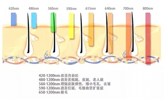 医美是什么意思 适合学生的医美项目