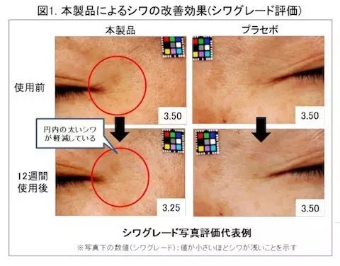 去皱纹的护肤品 抗老去皱哪家强