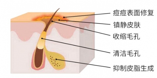 美白护肤品哪个好 一白遮三丑