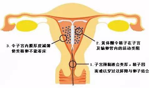 什么时候上环最合适