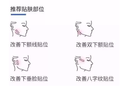 韩国瘦脸贴有用吗