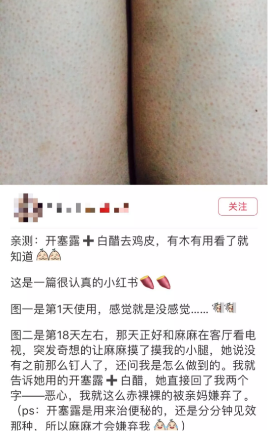 开塞露可以去鸡皮嘛