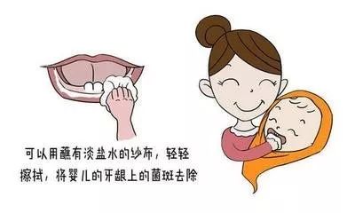 乳牙龋齿怎么治疗