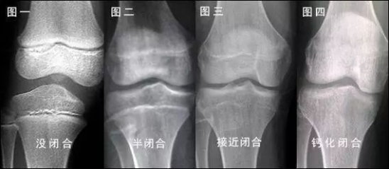 宝宝长高的秘诀 想要宝宝长高这2件错误事情要改