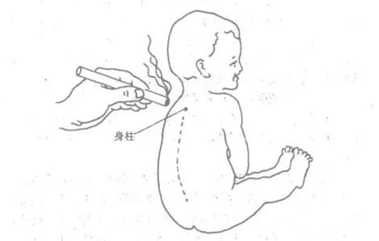 小孩艾灸身柱 小儿艾灸身柱