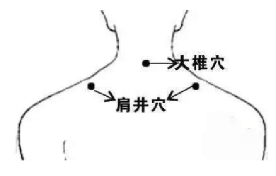 小儿荨麻疹推拿手法图 小儿推拿治疗荨麻疹