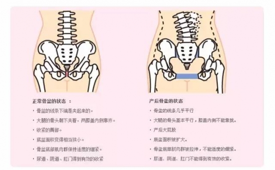 产后盆骨变大怎么办