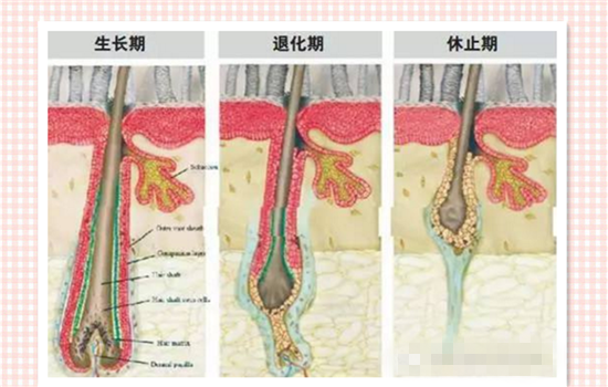 植发多久能长出头发 植发后多久开始生长