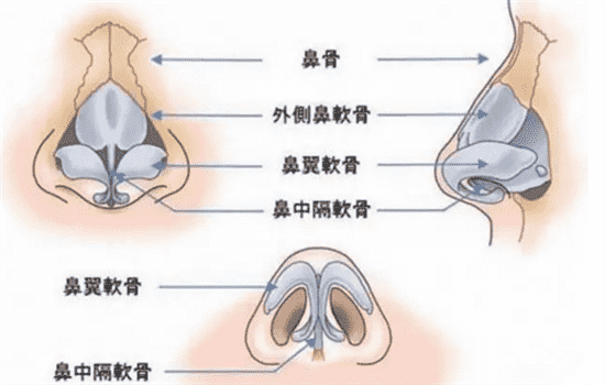 鼻头缩小怎么做 鼻头缩小手术怎么治疗