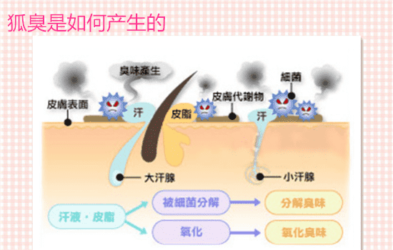 狐臭手术多久可以拆线 狐臭手术几天能拆线