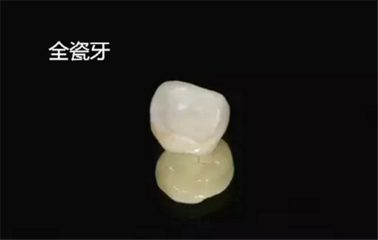 烤瓷牙和全瓷牙区别 烤瓷牙与全瓷牙有什么区别