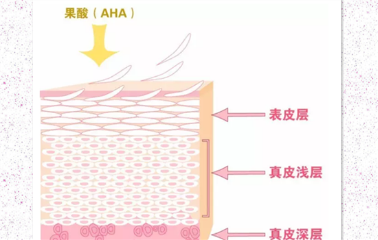 果酸换肤复发吗 果酸换肤会反弹吗