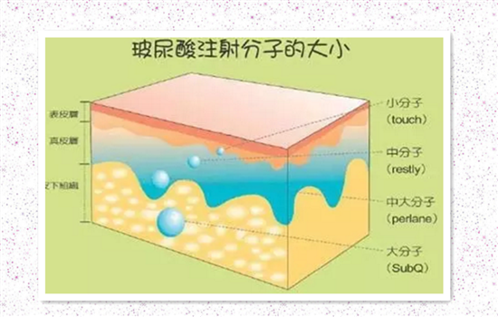 玻尿酸跟瘦脸针的区别 玻尿酸和瘦脸针一样吗