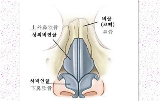 硅胶隆鼻取出多久消肿