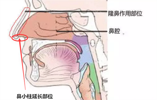 鼻小柱延长方法 如何延长鼻小柱