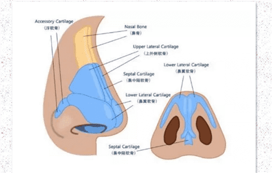 L型假体一定会顶穿吗 L型假体隆鼻穿孔几率