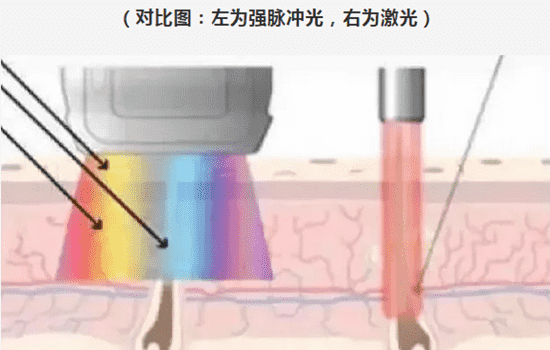 脸上有好多斑怎样祛斑 脸上有好多斑该怎么办