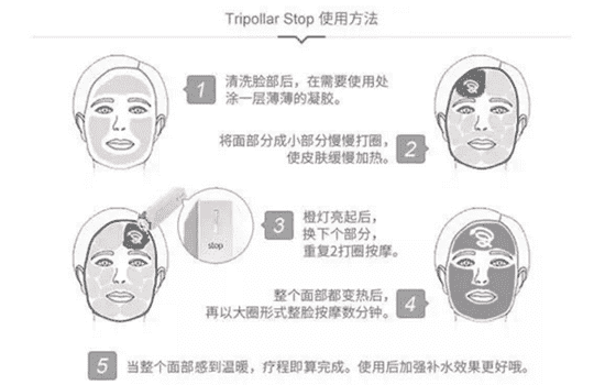 Tripollar stop使用频率 Tripollar stop用法