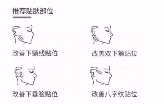 韩国瘦脸贴有用吗