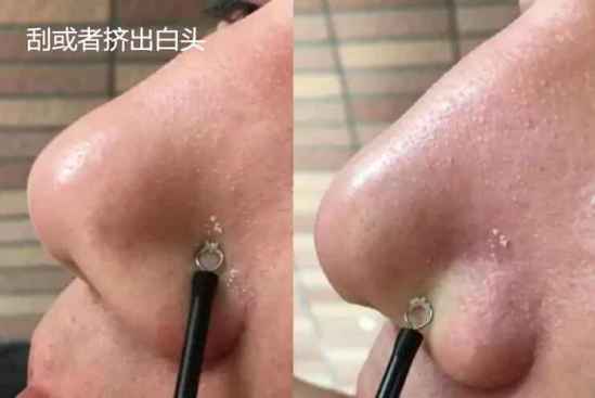 冻膜的正确用法 冻膜怎么使用