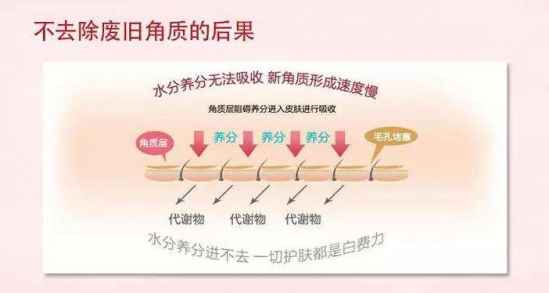 角质怎么去除 角质如何去除